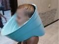 В Челябинской области спасли ребенка, голова которого застряла в горшке
